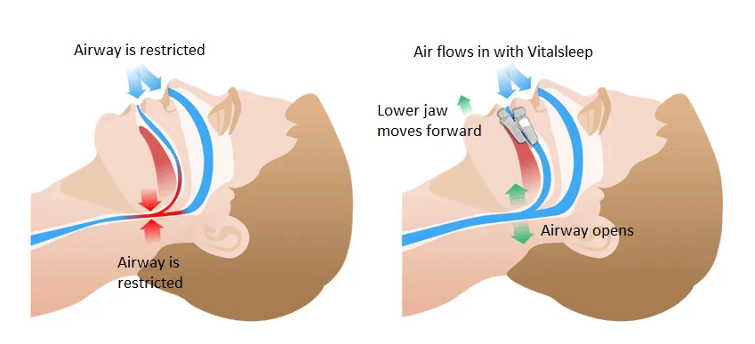 how vital sleep works