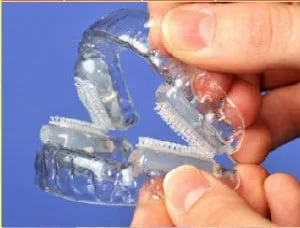 no-snoring-mouthpiece no snoring mouthpiece