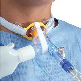 tracheostomy for sleep apnea