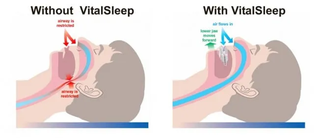 vitalsleep-image